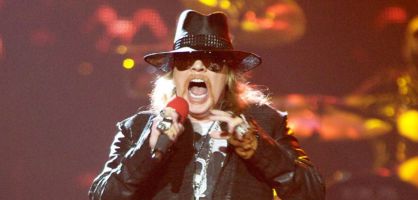 Esta es la radiografía que demuestra que Axl Rose se ha roto un pie
