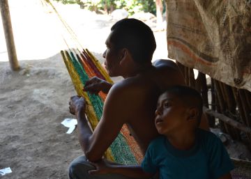 Un ni&ntilde;o que ha sufrido desnutrici&oacute;n aguda, con su padre.