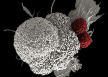 C&eacute;lula de un c&aacute;ncer de cabeza y cuello, atacada por dos gl&oacute;bulos blancos.