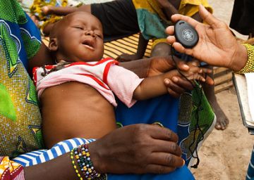 Una voluntaria mide la respiraci&oacute;n de un ni&ntilde;o en Mal&iacute;. 