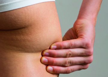 Si fuese un hombre, no tendría celulitis