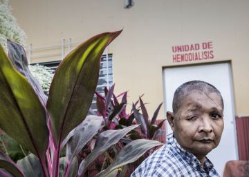 Héctor Miguel Corea, ante la unidad de hemodiálisis.