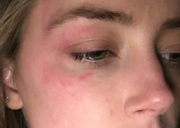 Amber Heard acusa de Johnny Depp de haberla golpeado