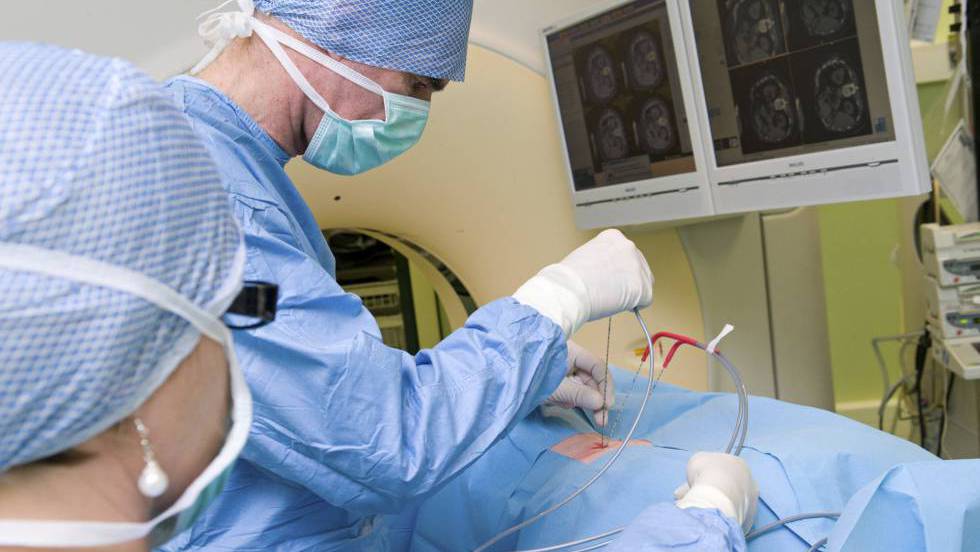 nuevo láser para el tratamiento del cáncer de próstata nuevo láser para el tratamiento del cáncer de próstata