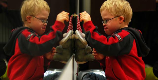 El s&iacute;ndrome de Down es un trastorno gen&eacute;tico en el cual una persona tiene 47 cromosomas, en lugar de los 46 habituales.