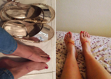 Por qué las españolas se rebelan ahora contra el calzado asesino