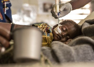 Un ni&ntilde;o es atendido en el hospital de MSF en Madaoua, N&iacute;ger.