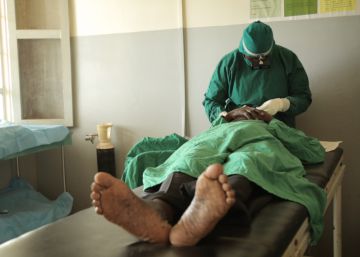 El tracoma es la principal enfermedad infecciosa causante de ceguera en el mundo. La cirug&iacute;a alivia el dolor, pero no se recupera la visi&oacute;n perdida. 