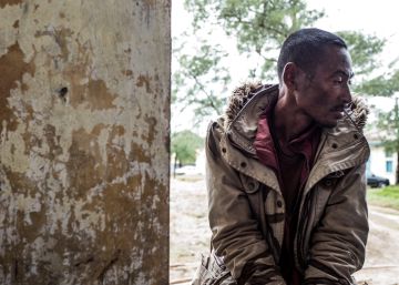 Un minero ilegal, paciente de tuberculosis, en Fort Dauphine, en Madagascar.