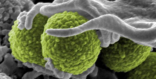 El Staphylococcus aureus ha desarrollado resistencia a varios antibi&oacute;ticos.