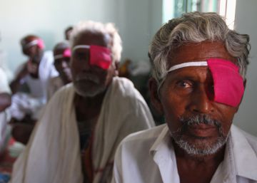 Aravind Eye Care System.