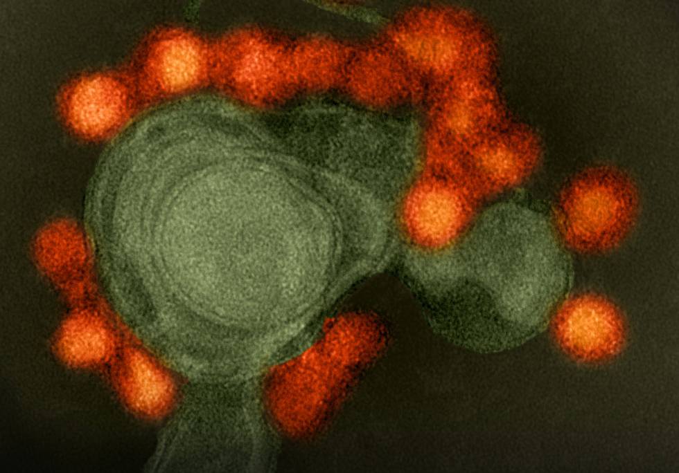Imagen por microscopio electrÃ³nico del virus del Zika (en rojo) atacando la membrana celular.