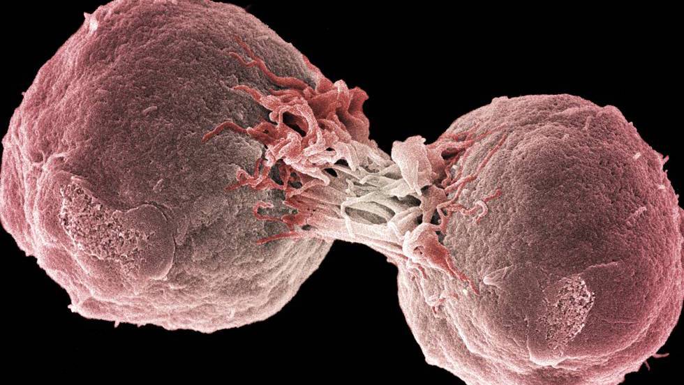 cancer de prostata imunoterapia