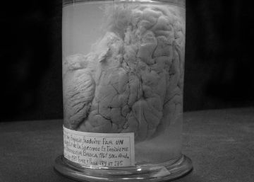 El hombre que solo decía «tan-tan»