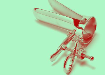 9 dudas muy íntimas que nos daba pudor plantear al ginecólogo, resueltas