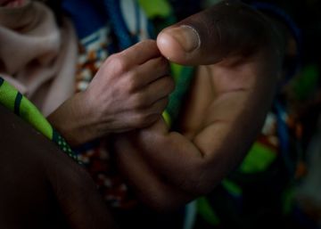 Hadida, de cinco meses y con malnutrición aguda severa agarra el dedo de su madre, Fátima, en el hospital de Diffa, en Níger.