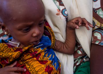 Yabissam, con malnutrici&oacute;n aguda severa es atendida en el asentamiento informal de Nguel Wanzam de Diffa, N&iacute;ger.