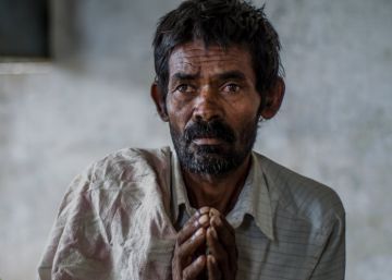 Venkatesh, de 45 a&ntilde;os, enfermo de tuberculosis en Htpalli (India).