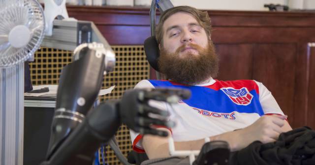 Copeland con el implante cerebral y el brazo robótico.