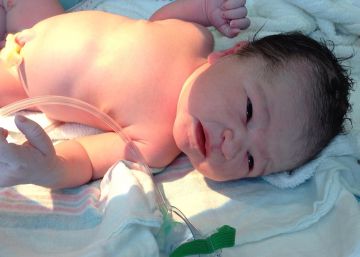 La bebé que nació dos veces
