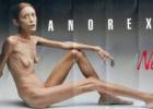 Petición para cerrar el canal de una ‘youtuber’ por inducir a la anorexia