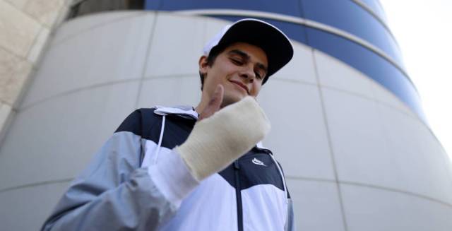 Bruno Hortelano muestra su mano reconstruida.