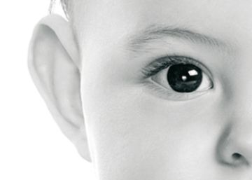 La española que corrige las orejas de soplillo sin cirugía