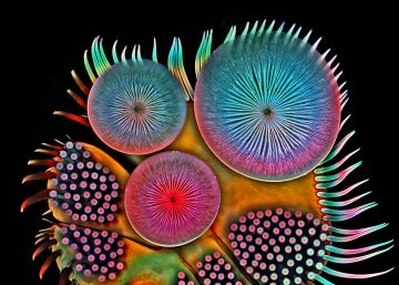 Pata delantera (tarso) de un escarabajo buceador macho. Microscopio 1000x. 