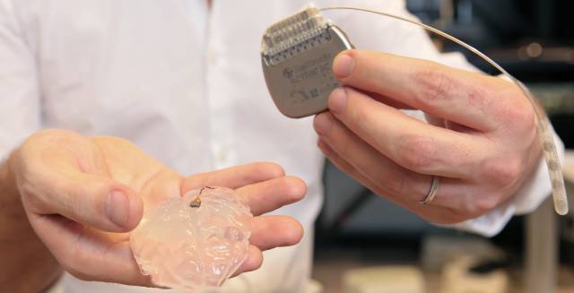 Los distintos elementos del interfaz cerebro m&aacute;quina.