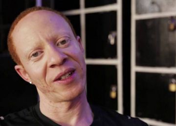 Albinos en la pasarela