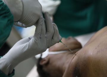 Las autopsias ‘low cost’ demuestran su efectividad en países pobres