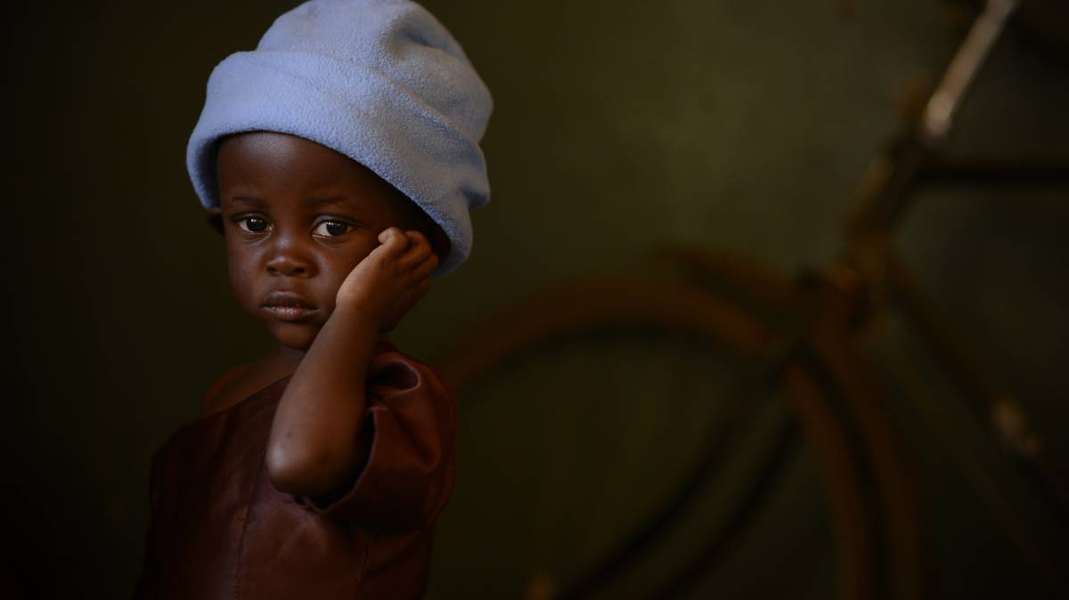 Desire, de dos años vive en Balaka, Malawi, y sufre desnutrición aguda.