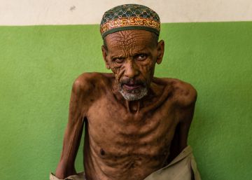 Etiopía: una contrarreloj contra el hambre