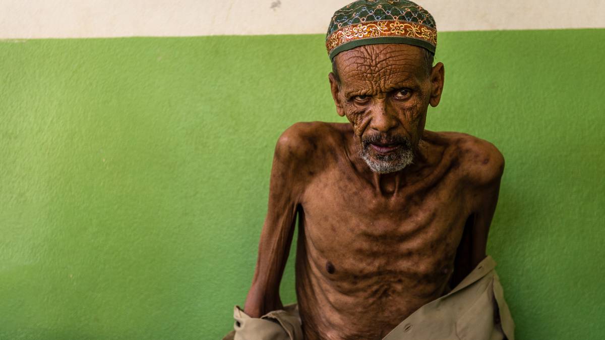 Etiopía: una contrarreloj contra el hambre