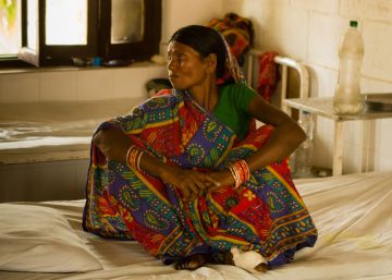 En el hospital con más leprosos del mundo