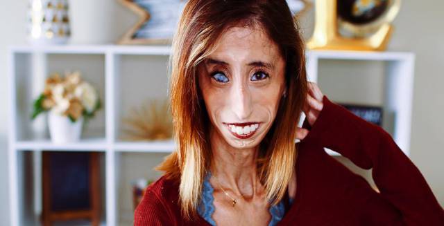 Lizzie Velasquez en una fotograf&iacute;a del pasado mes. 