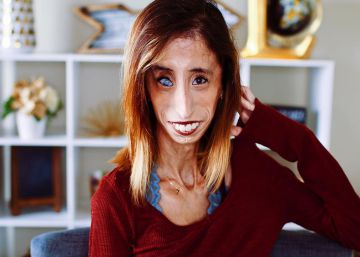 Lizzie Velasquez en una fotograf&iacute;a del pasado mes. 