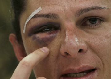 Mexican senator vows to fight gender violence after vicious attack