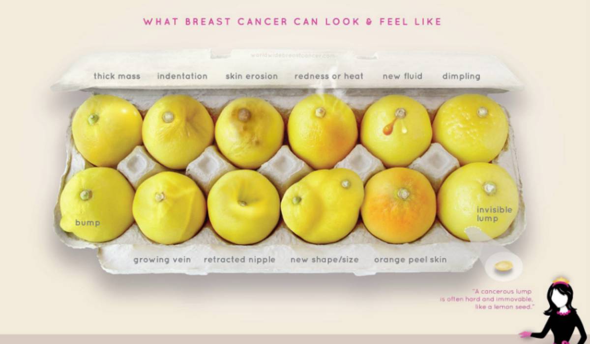 #KnowYourLemons: Una foto y 12 limones para aprender a detectar el cáncer de mama