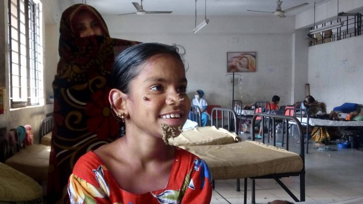 Bangladesh identifica a la primera ‘mujer árbol’