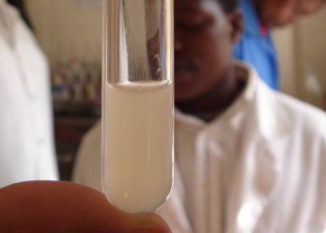 ¿Por qué es necesario un mejor método para descartar las meningitis?