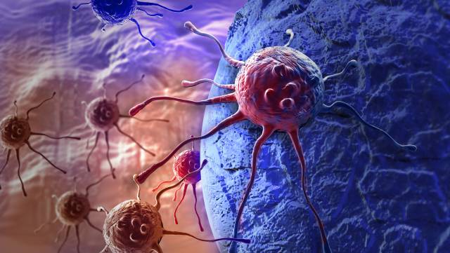 Una c&eacute;lula cancerosa.