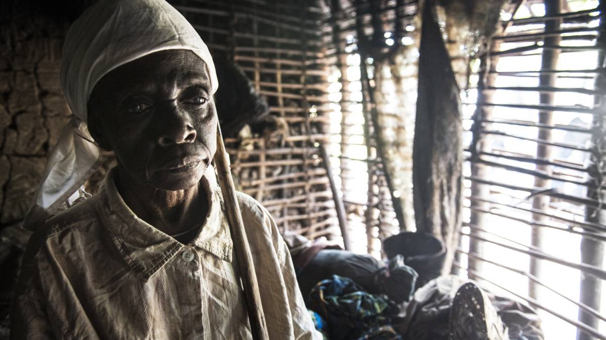 Las picaduras que te dejan ciego