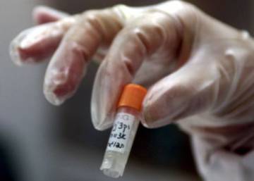 España tiene dos millones de vacunas de viruela caducadas