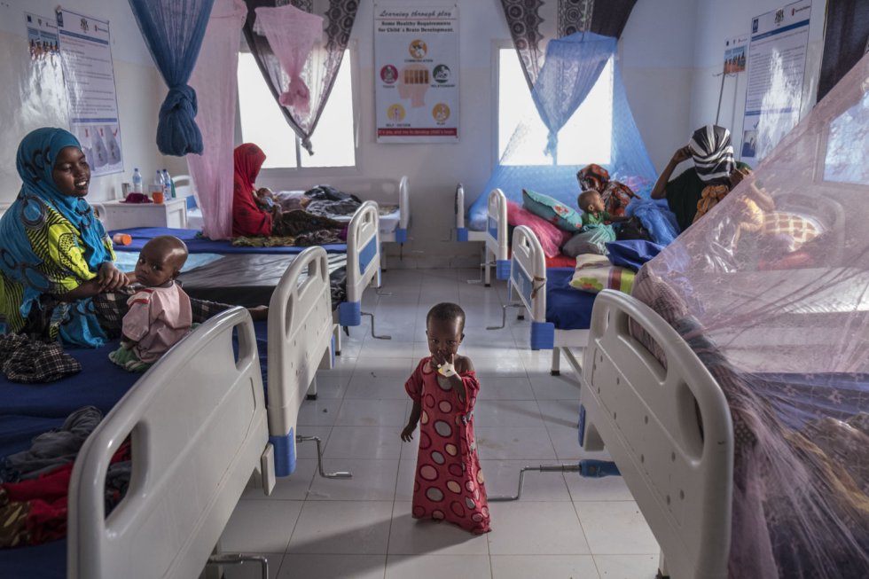 No hospital de Garowe, norte da Somália, as crianças internadas com desnutrição aguda severa recebem tratamento nutricional da Save the Children. Além da escassez de alimentos, a falta de água limpa provocou a propagação de doenças como o cólera.