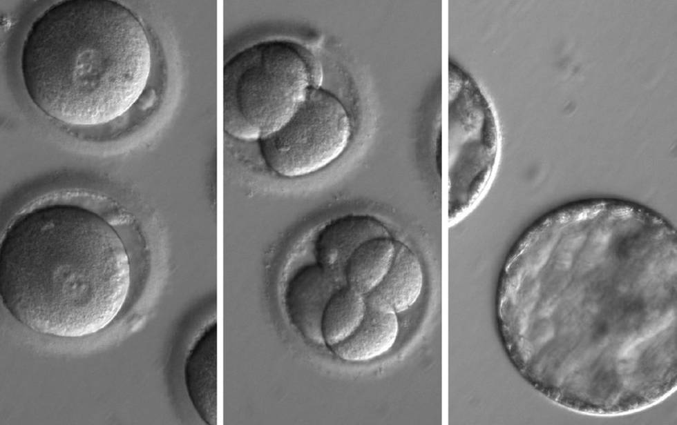 Tres fases de desarrollo de los embriones tratados con CRISPR.