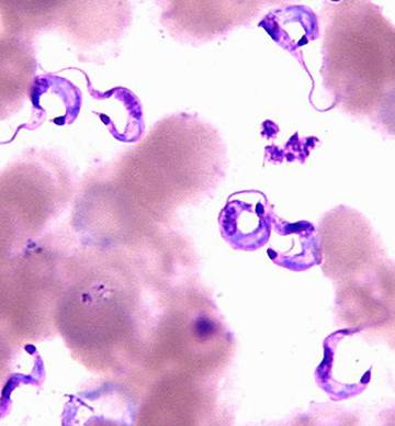 ¿Cómo el parásito Plasmodium causa enfermedades en humanos?