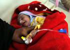 “Muchos yemeníes tienen que escoger si pagar para llevar a sus hijos al médico o comer ese día”