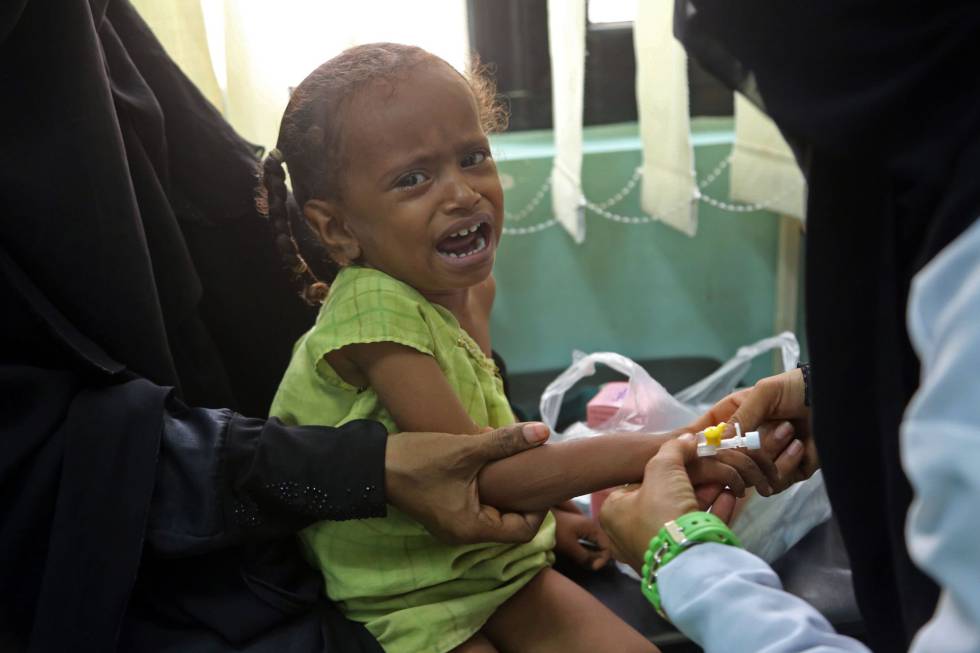 Una niña yemení sospechosa de ser infectada con cólera, en un hospital de Hudeyda (Yemen).
