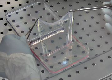 Dos alas para el niño mariposa